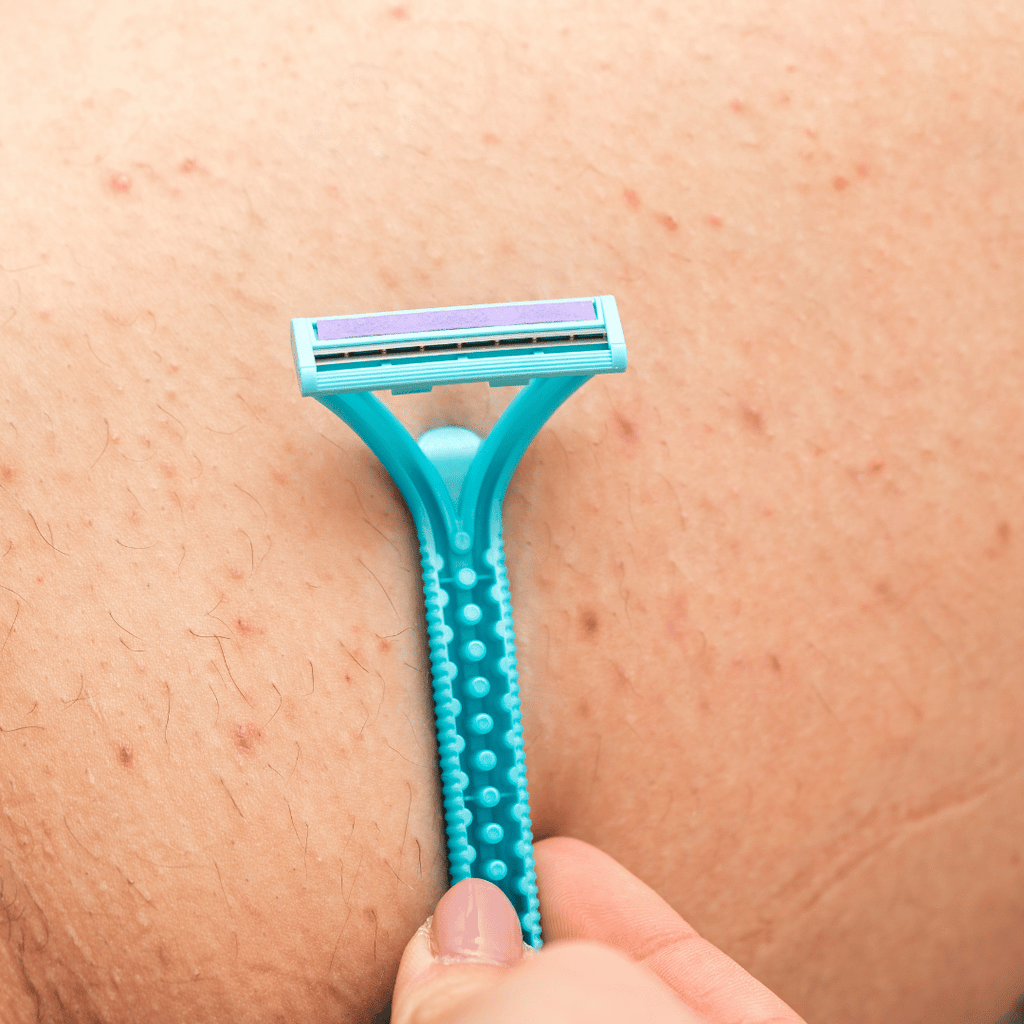 How to get rid of razor bumps overnight